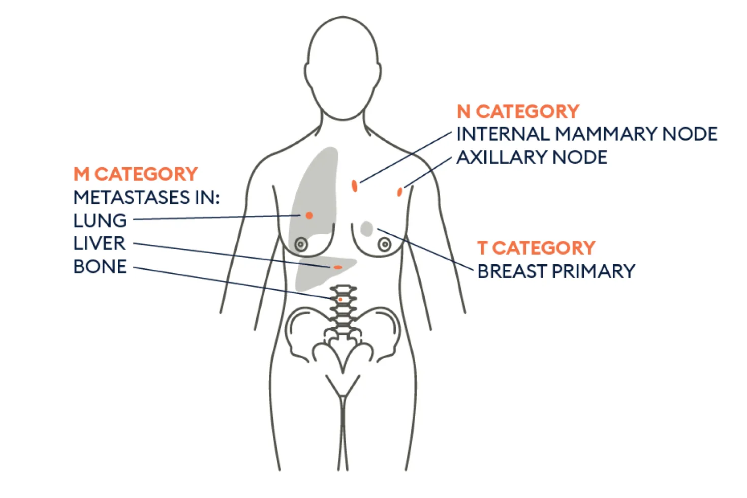 TNM explanatory graph