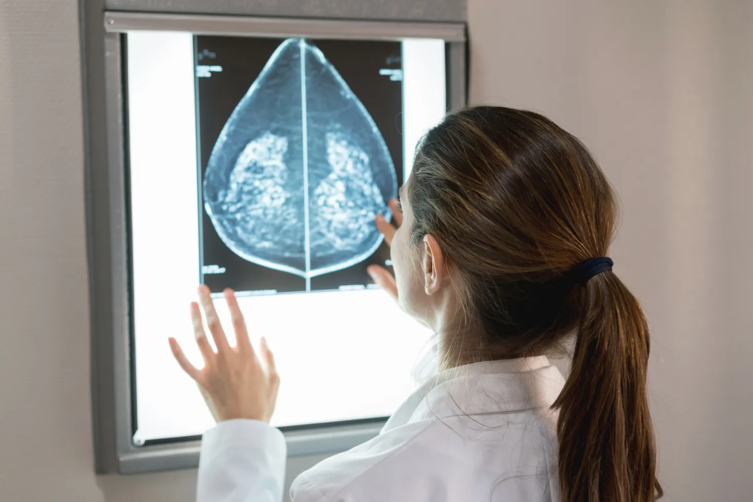 gynocologist looking at a patients mammogram at the hospital