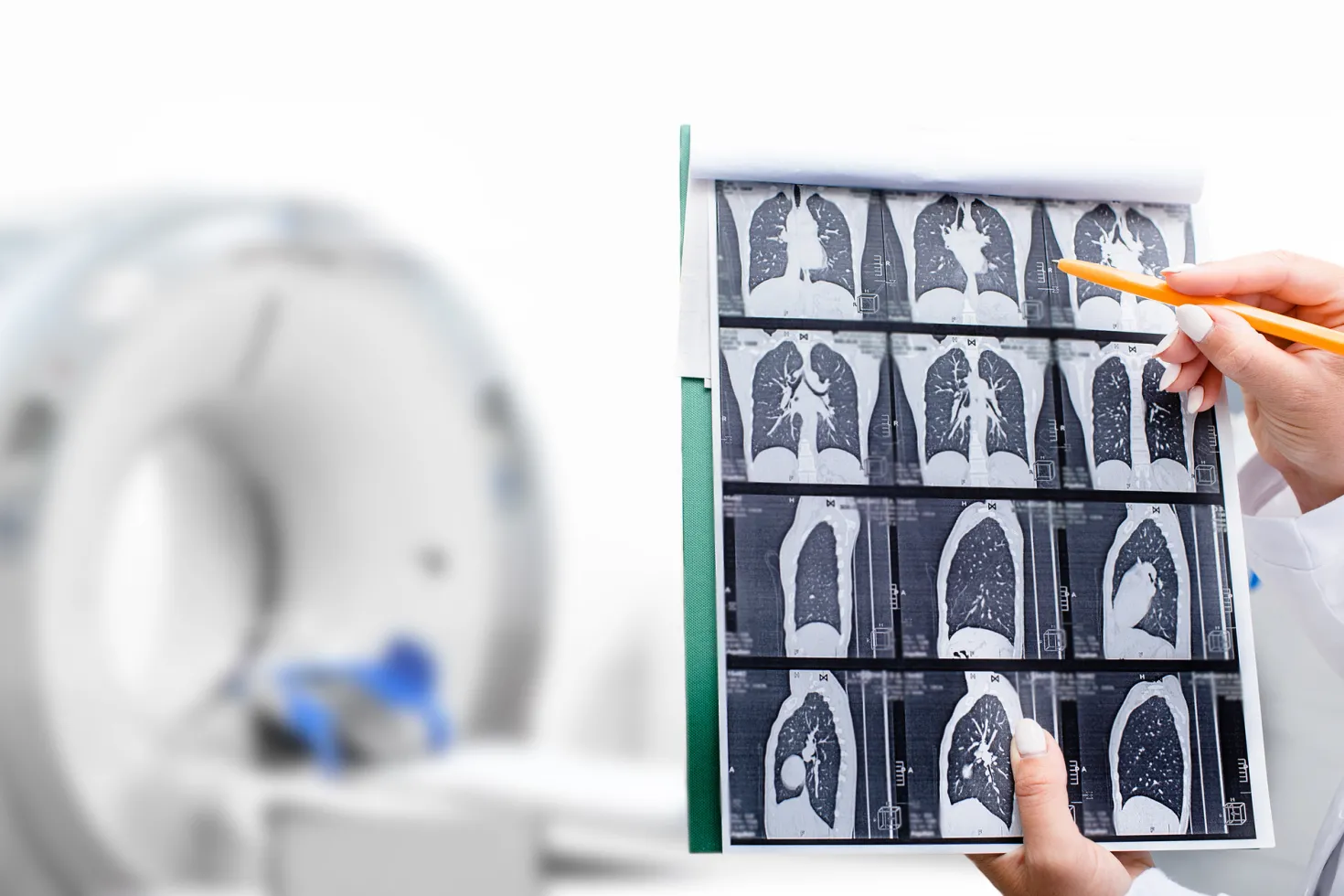 Hand of a Radiologist showing tomography scan of a patient's lungs with blurry CT machine with patient in the background 