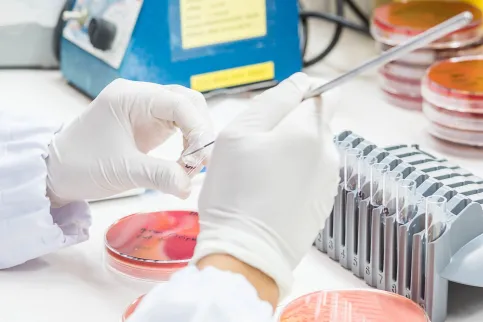Close up on hand medical technicians working on bacterial culture and drug resistance of pathogens in laboratory.