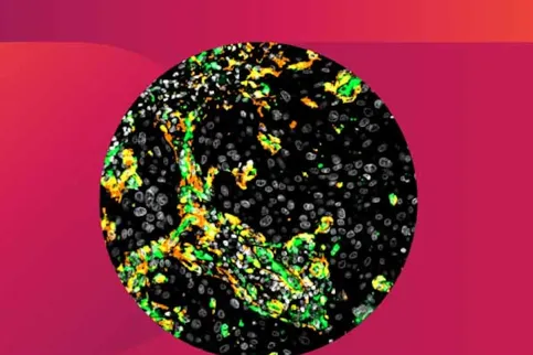 cover of the International Journal of Cancer