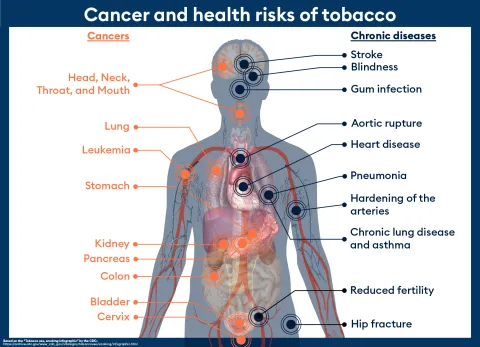 Diagram based on the “Tobacco use, smoking infographic” by the CDC