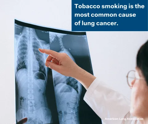 tobacco control image 4