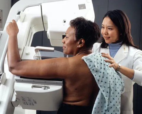 The weekly number of breast cancer diagnoses are estimated to have fallen more than 50% during the pandemic. Image from the National Cancer Institute.