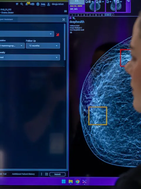 Woman wearing black polo neck sweater looking an AI analysis of a breast cancer scan