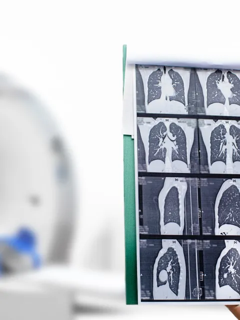 Hand of a Radiologist showing tomography scan of a patient's lungs with blurry CT machine with patient in the background 
