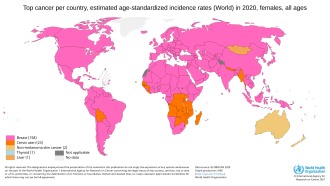 Breast-cancer-graph-top-cancer-per-country-new-cases-2020-female-web.png